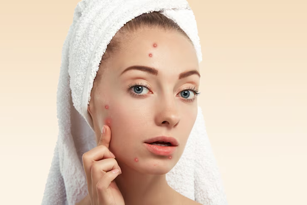 The Power of Hyaluronic Acid + Niacinamide: Hydration and Brightening Combined